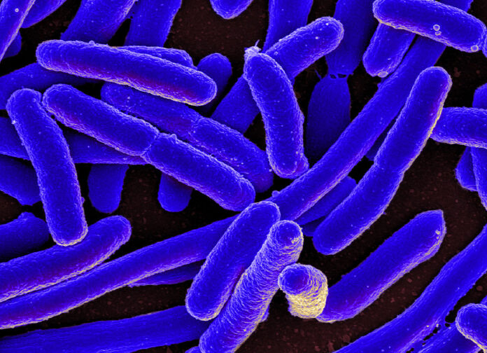 E.coli Outbreak Linked to Food Item Sparks Health Concerns: Tech & Science Daily Podcast