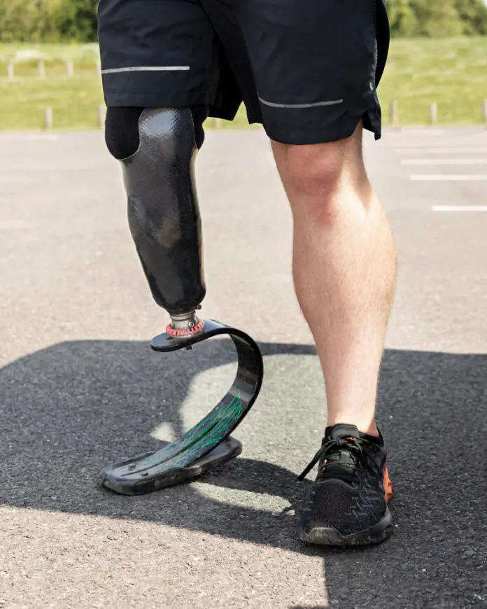 Bride Overcomes Amputation to Walk Down Aisle, Sporting Darkly Humorous Tattoo on Prosthetic Leg