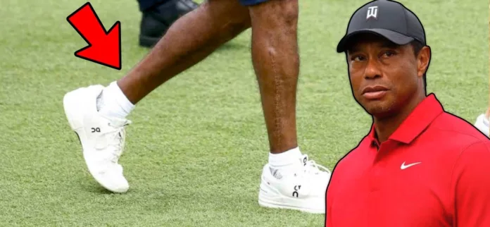 Tiger Woods’ Masters Nightmare: Emergency Achilles Surgery