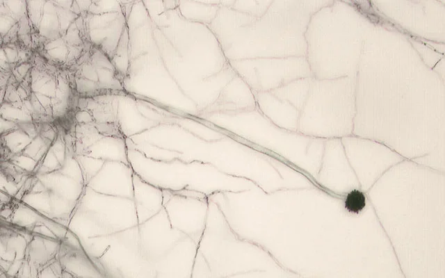 Deadly Fungal Infections Rising Amid Climate and Resistance