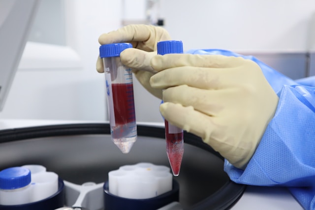 NHS Offers World-First Myeloma Treatment Using Trojan Horse