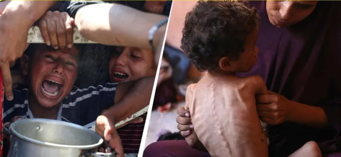 Gaza Starvation: Children, Pregnant Women Face Hunger