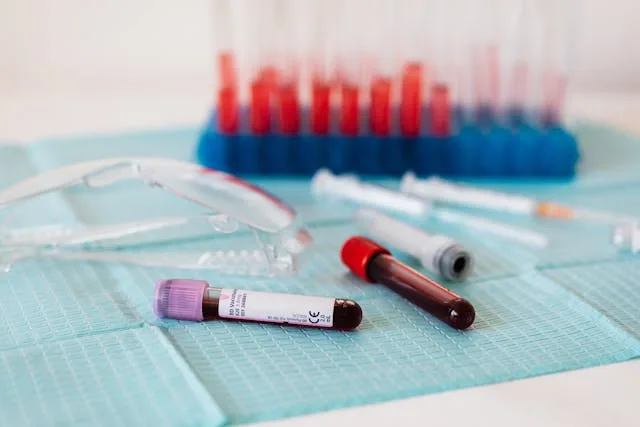 Breakthrough Blood Test Detects Ovarian Cancer