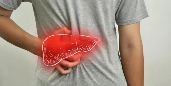 Liver Disease Could Affect 1.8 Billion by 2050, Study Warns