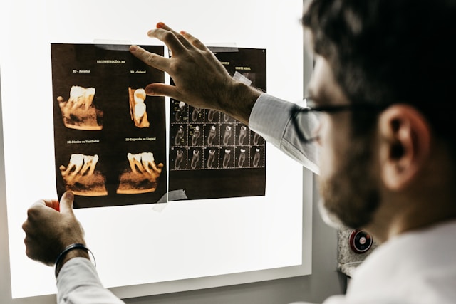 AI to Help NHS Doctors Detect Fractures on X-Rays