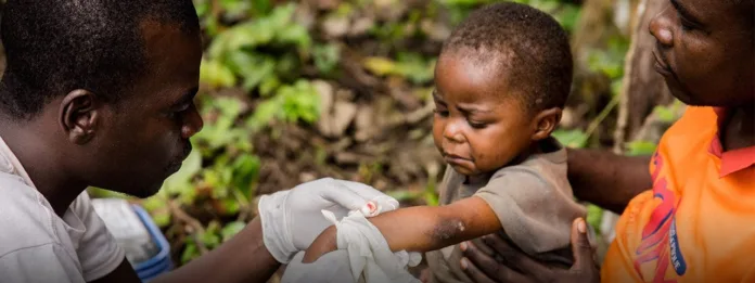 UK Readies for Mpox Cases Following WHO Global Emergency