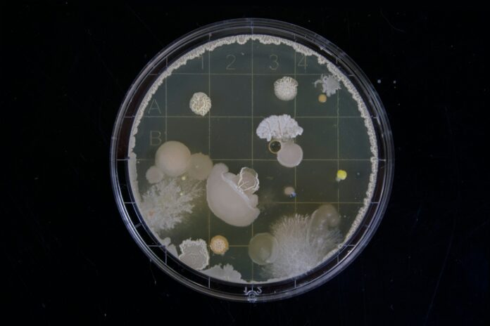 Drug-resistant superbugs can be avoided